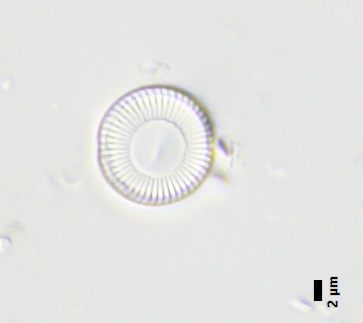 BESTA_Tomas_-_obr_2-Cyclotella_gamma.jpg