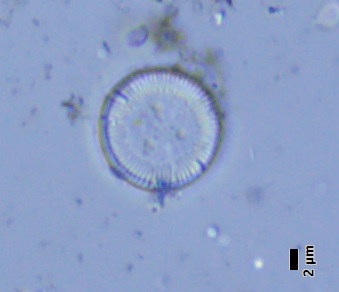 BESTA_Tomas_-_obr_3-Cyclotella_ocellata.jpg