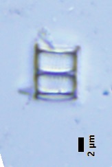 BESTA_Tomas_-_obr_1-Aulacoseira_pusilla.jpg