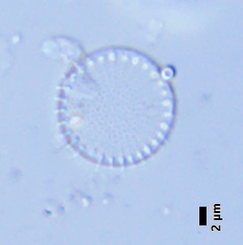 BESTA_Tomas_-_obr_7-Stephanodiscus_hantzschii.jpg