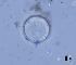 BESTA_Tomas_-_obr_3-Cyclotella_ocellata
