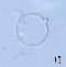 BESTA_Tomas_-_obr_7-Stephanodiscus_hantzschii.jpg